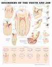 פוסטר אנטומיה - בעיות של השיניים והלסת 50X70 ס"מ