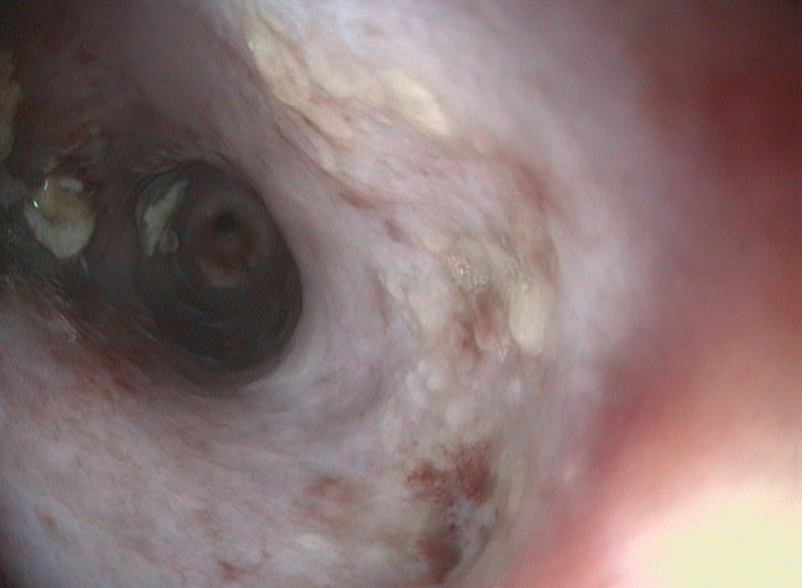 גוף זר בגרון בכלבה