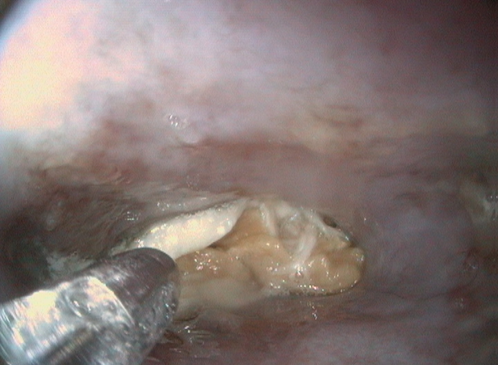 אנדוסקופיה - משהו תקוע בגרון בכלב