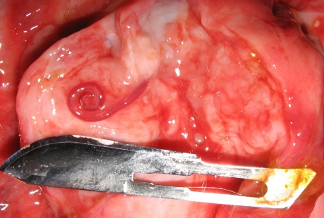 תולעת הפארק בתוך גרנולומה