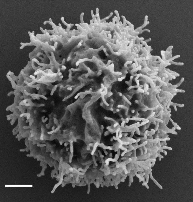 אצבעות על פני השטח של תא T. צולם באמצעות מיקרוסקום אלקטרונים סורק באדיבות מכון ויצמן למדע
