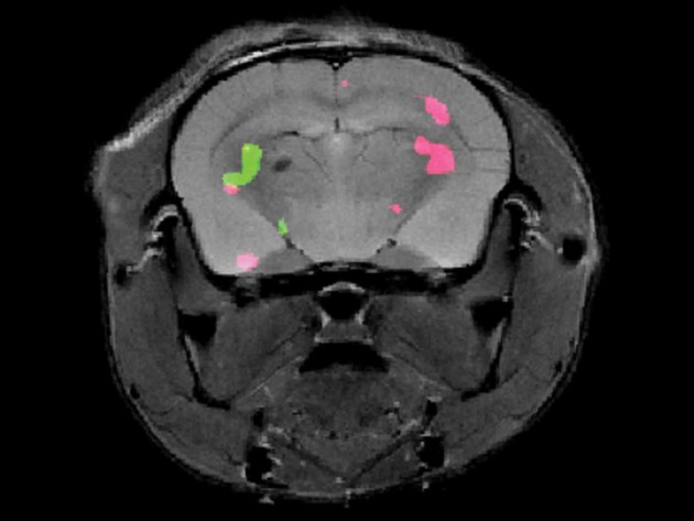 סריקת MRI של מוח עכבר מציגה בעזרת שני צבעים ביטוי של שני חלבונים שונים. קפיצת מדרגה בתחום הדימות. צילום מכון ויצמן למדע