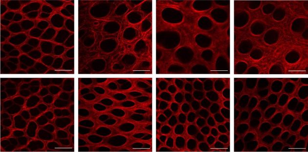 המרקם הבין-תאי במעי של עכברים רגילים (למעלה, שמאל) הולך ומשתבש בשל הדלקת (למעלה, אמצע וימין). לעומת זאת, בעכברים ללא HSF1 (למטה, שמאל) באותם התנאים, לא מתפתחת דלקת והמרקם הבין-תאי נותר תקין לאורך זמן (למטה, אמצע וימין)