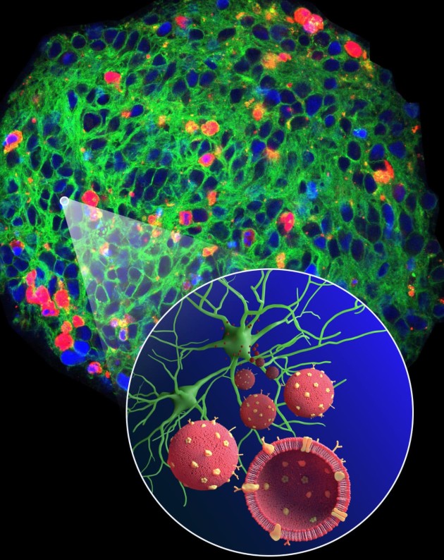 חלקיקים (אדום) בהשראת הטבע משמשים לשיגור תרופות היישר לנוירונים (ירוק). צילום דוברות הטכניון