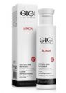 Acnon spotless skin refresher gigi