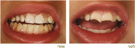 שחזורים אסתטיים