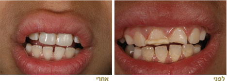 שחזורים אסתטיים
