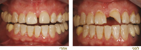 שחזורים אסתטיים