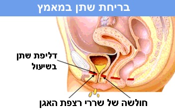 אינה בקר- טיפול בבריחת שתן במאמץ