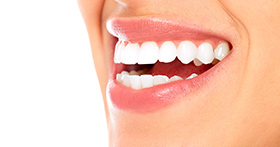 הלבנת שיניים בחולון